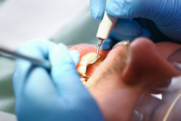 Best Broken or Cracked Tooth Emergency Dentist in Carteret, NJ