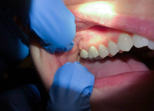 Best Orthodontic Emergency Dentist in Carteret, NJ