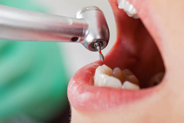 Best Pediatric Emergency Dentist in Carteret, NJ